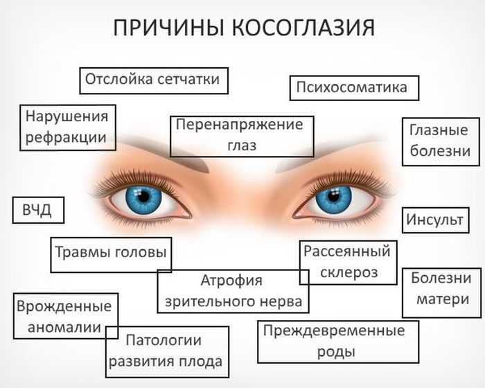 Люди с одним глазом: особенности и адаптация к монокулярному зрению